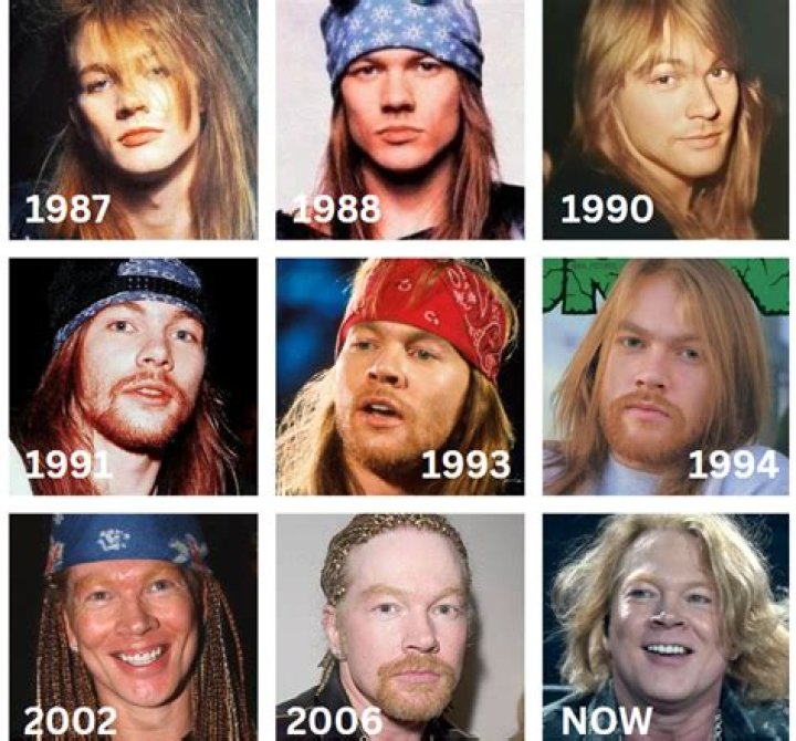 Axl Rose from Face Changes That Shocked the World E! News