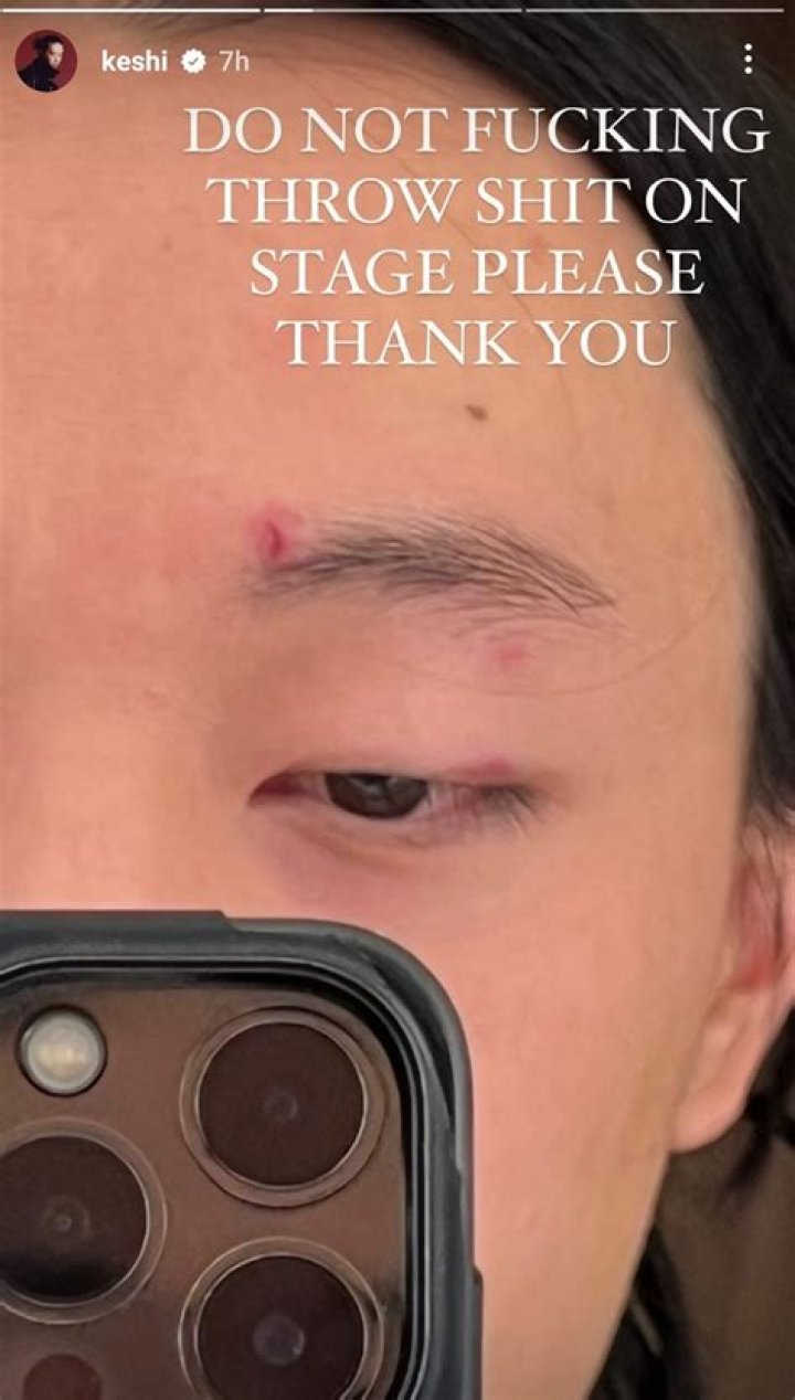 Keshi Injured After Young Fan Throws Gift To Him While He Performs, But