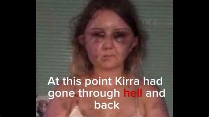 Unveiling The Kirra Hart Attack Video: Insights And Revelations