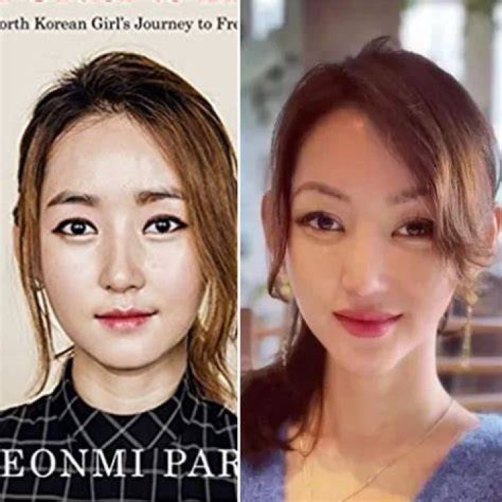 Unveiling The Transformative Journey Of Yeonmi Park: Surgery And Beyond